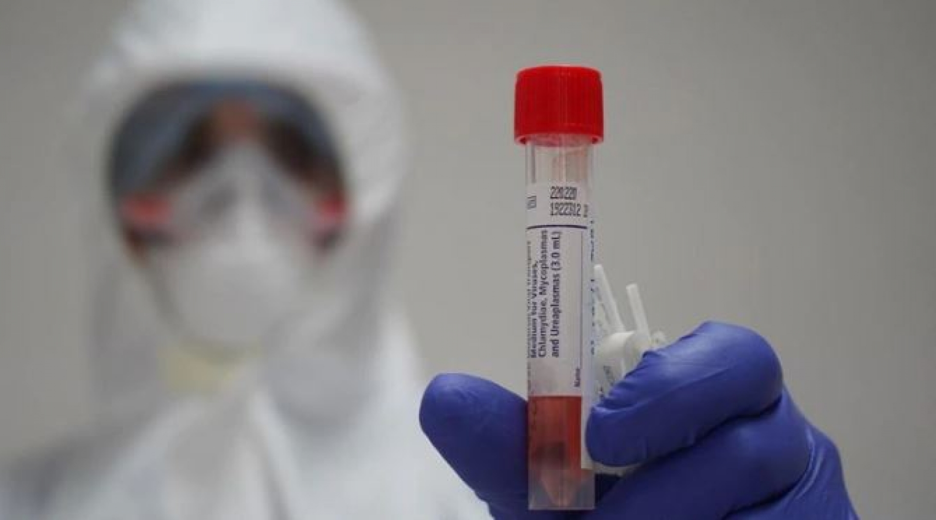 ¿Cómo hacerse la prueba de COVID en un laboratorio privado?