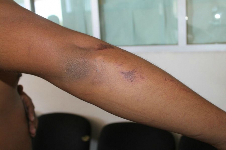 Denuncian a policía del Mando Único por golpear a un bombero