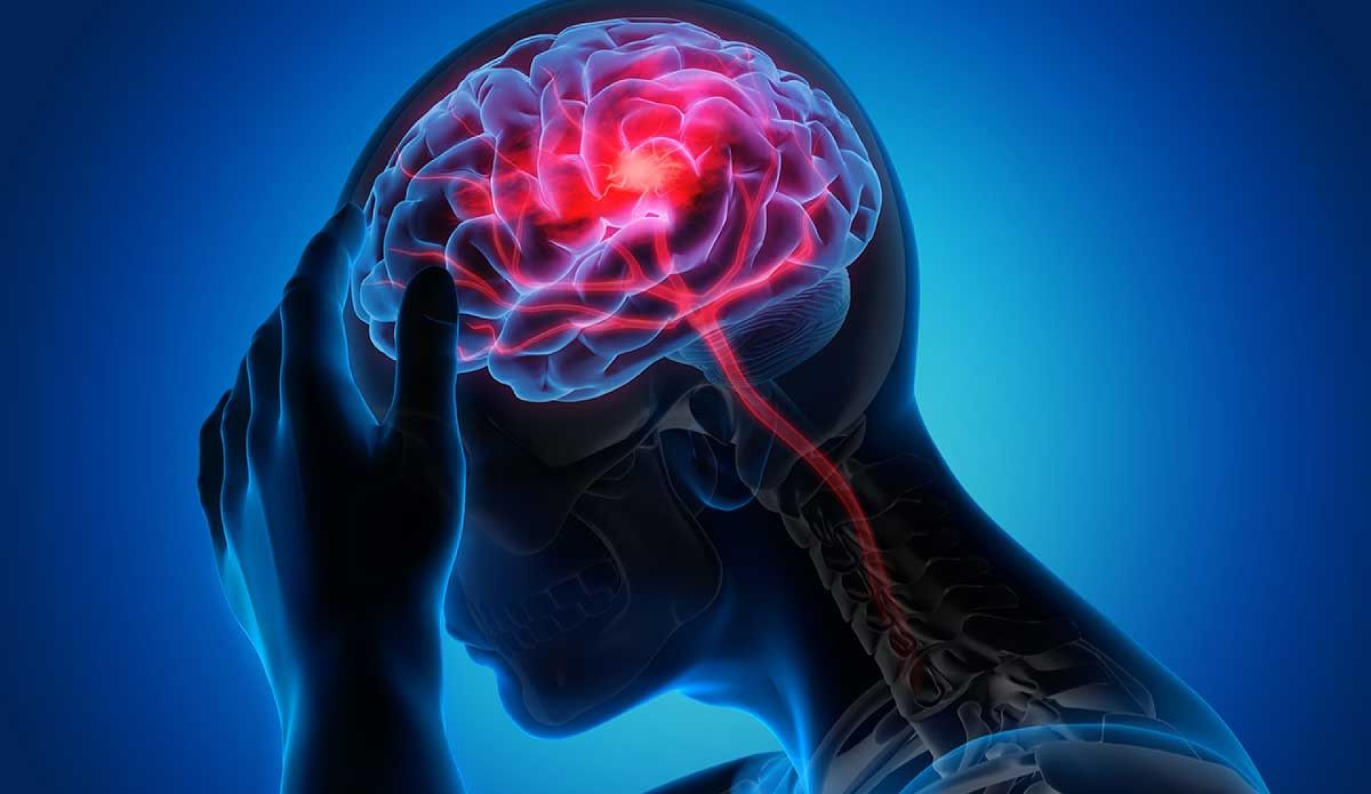 Cómo actuar y prevenir un derrame cerebral para proteger tu salud