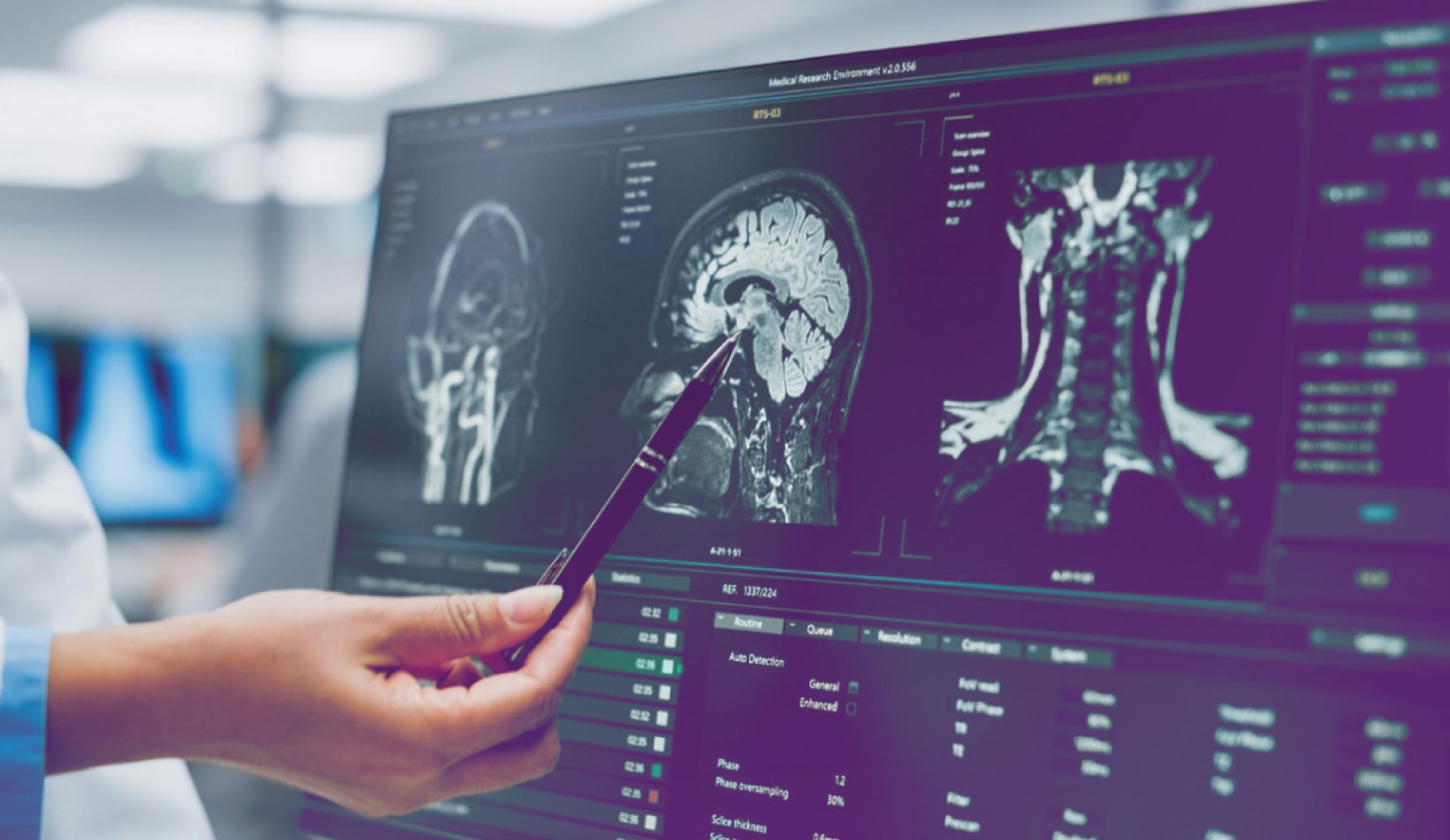 Tecnología de precisión revoluciona la neurocirugía y la reparación nerviosa
