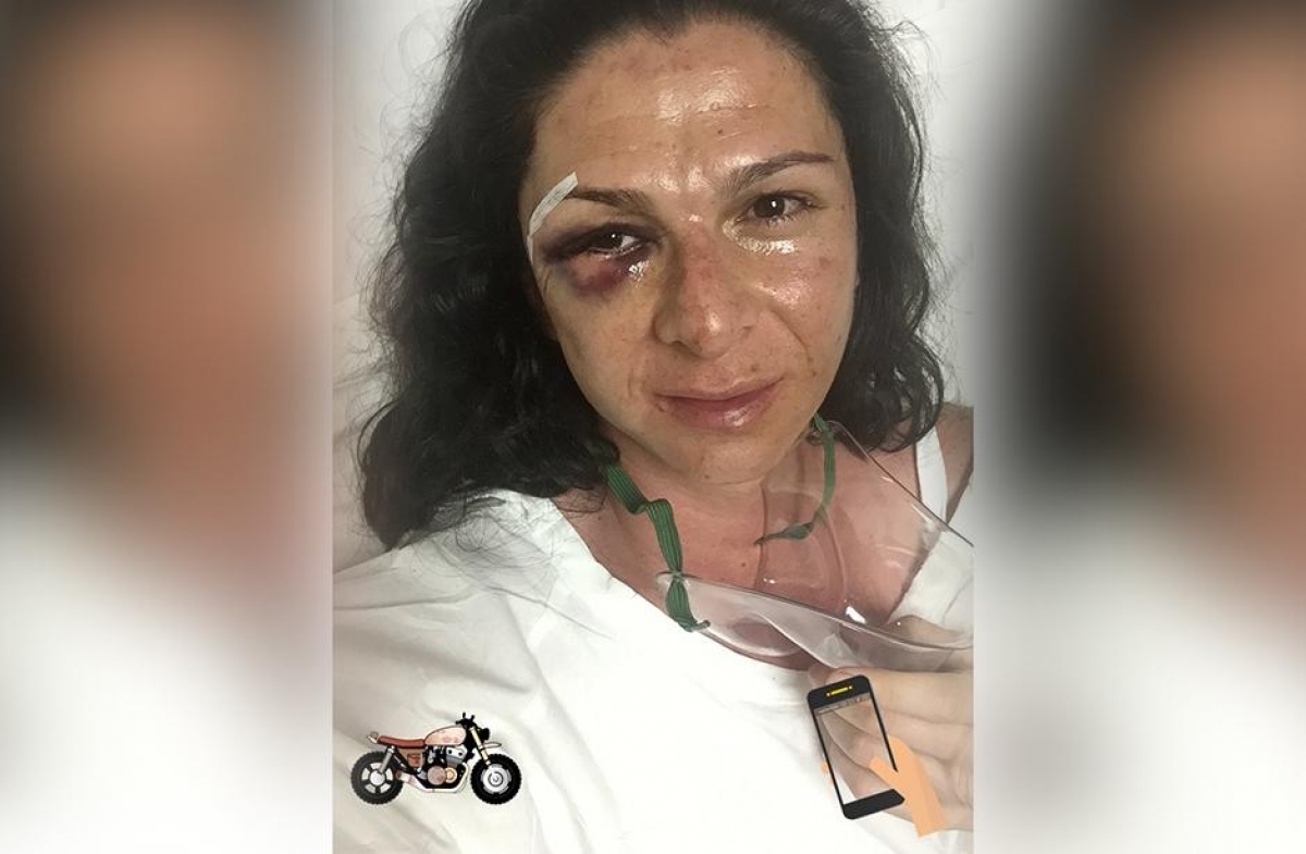PGR investiga agresión contra Ana Gabriela Guevara