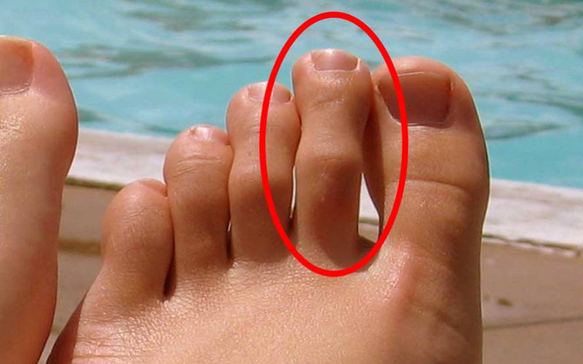 ¿Tienes este dedo del pie más largo? ¡Pues ten cuidado!