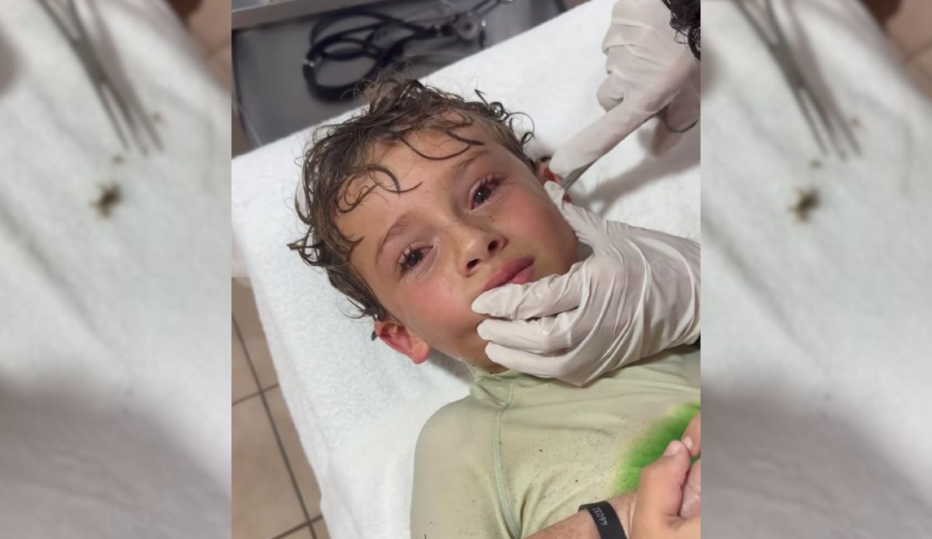 Niño se vuelve viral tras cangrejo dentro de su oreja en playa mexicana