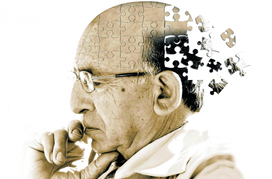 Sólo 5% de casos de Alzheimer fue "heredado"