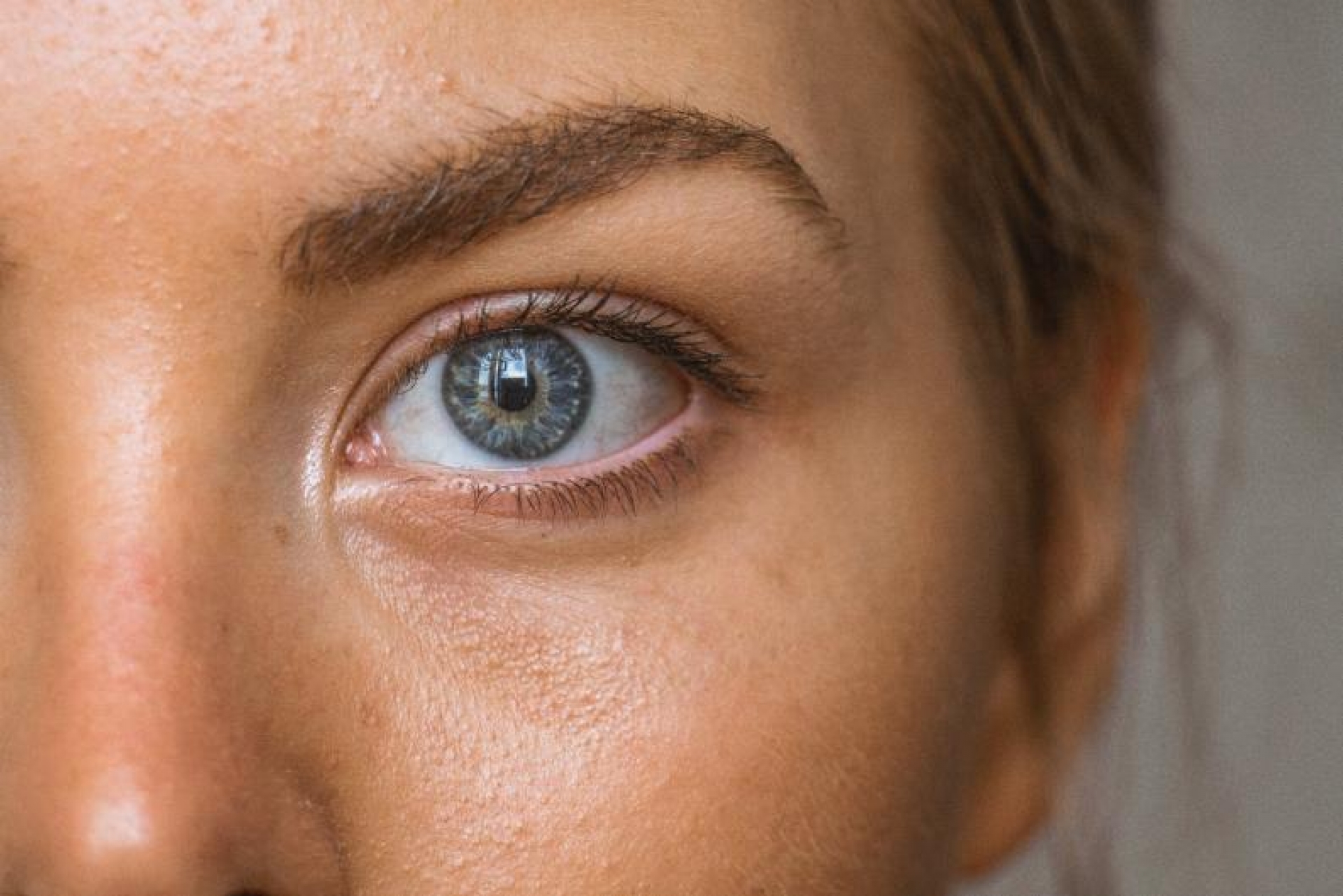 ¿Tienes piel grasa? Expertos te brindan los consejos más efectivos para cuidarla