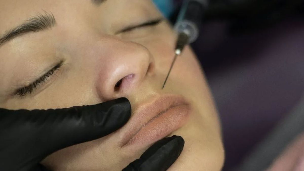 Baby botox: qué es y quién puede aplicárselo