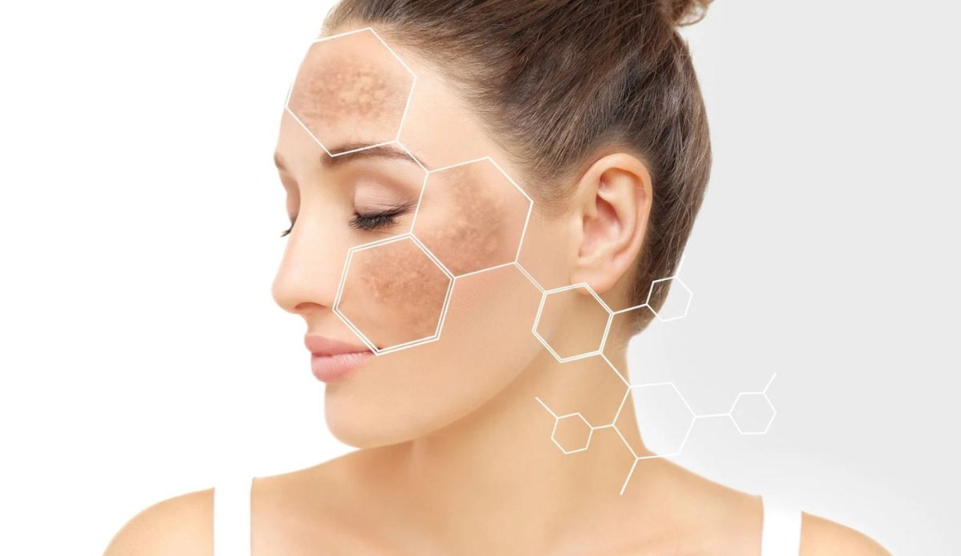 Oxyresveratrol, el activo natural que elimina manchas y cuida la piel