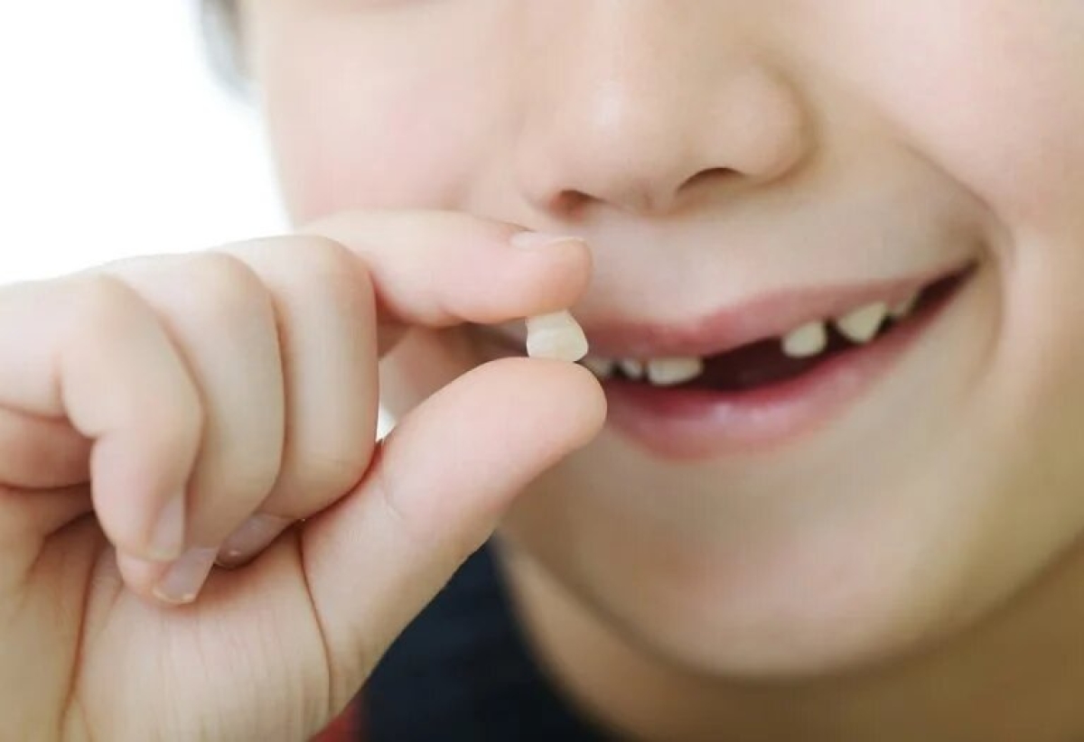 La salida y caída de los dientes de leche en la infancia