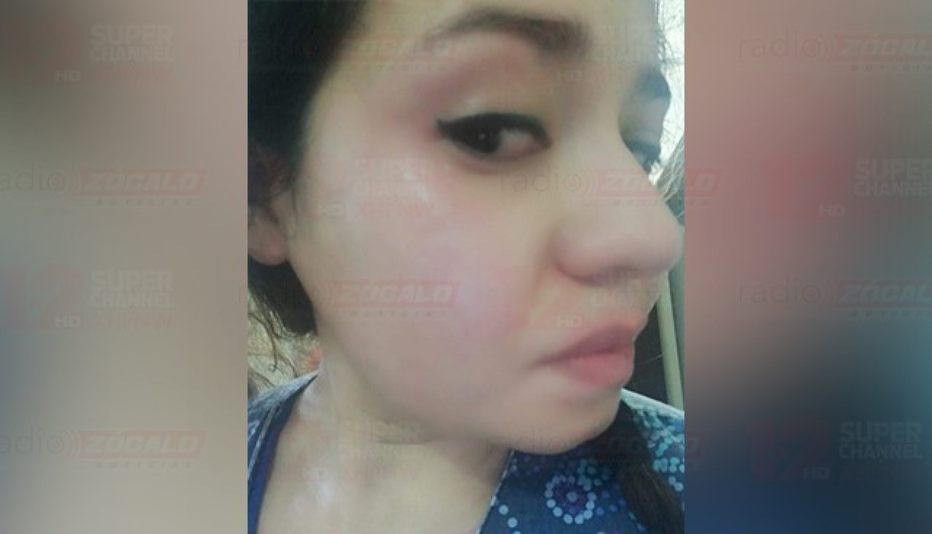 Golpean a enfermera al salir de hospital en Piedras Negras