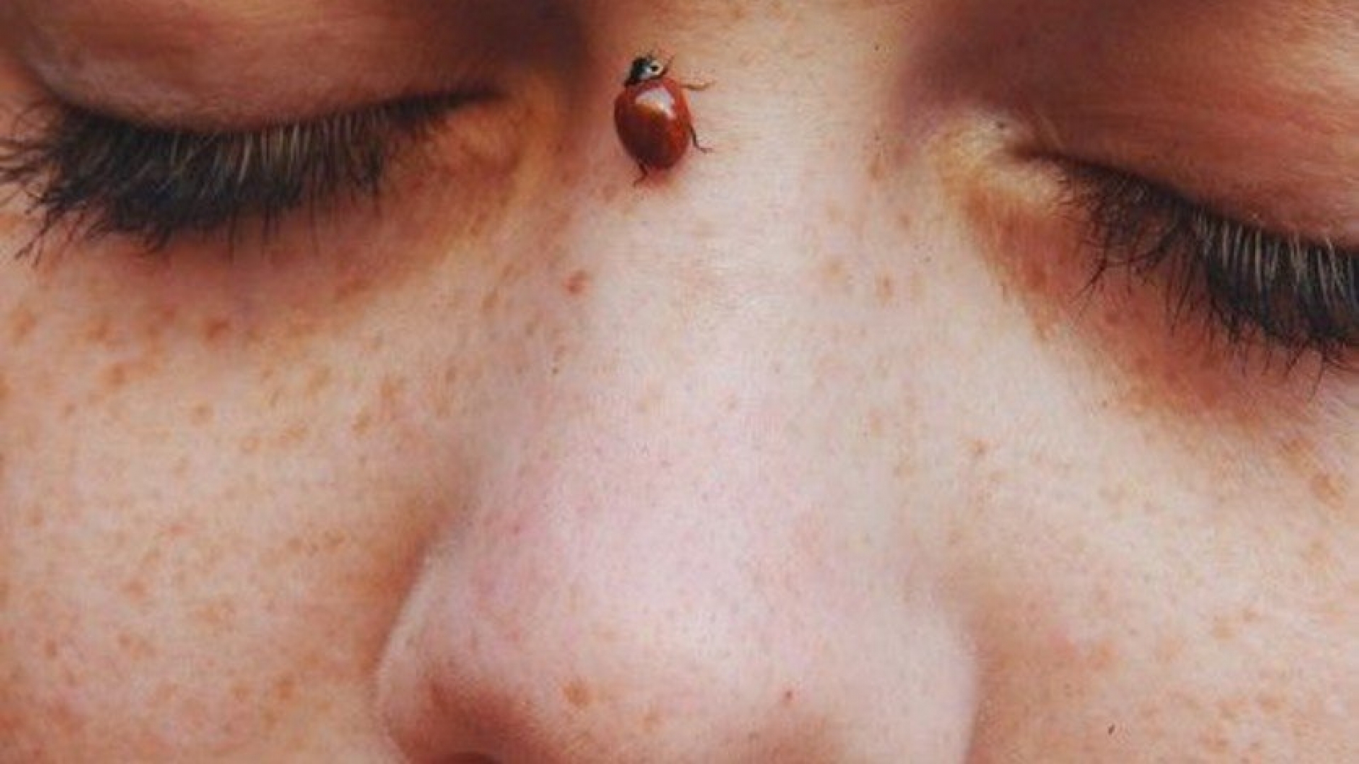 Por qué debes visitar a un dermatólogo por lo menos una vez al año