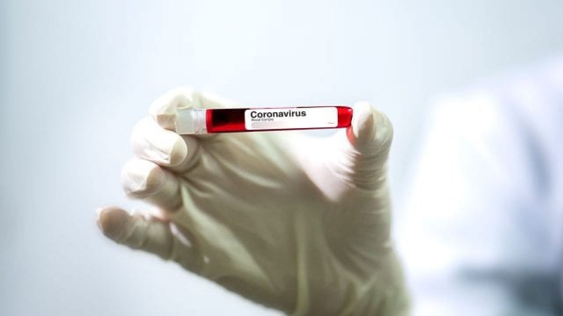 Capital china inicia exámenes masivos por Covid-19 ante segunda ola de contagios