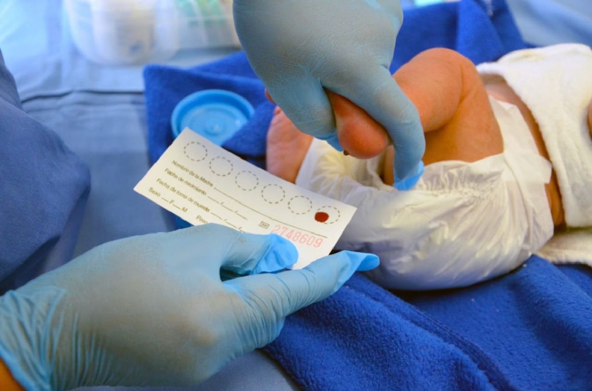 Gestionarán recurso estatal para mantener aplicación del tamiz metabólico neonatal en Morelos