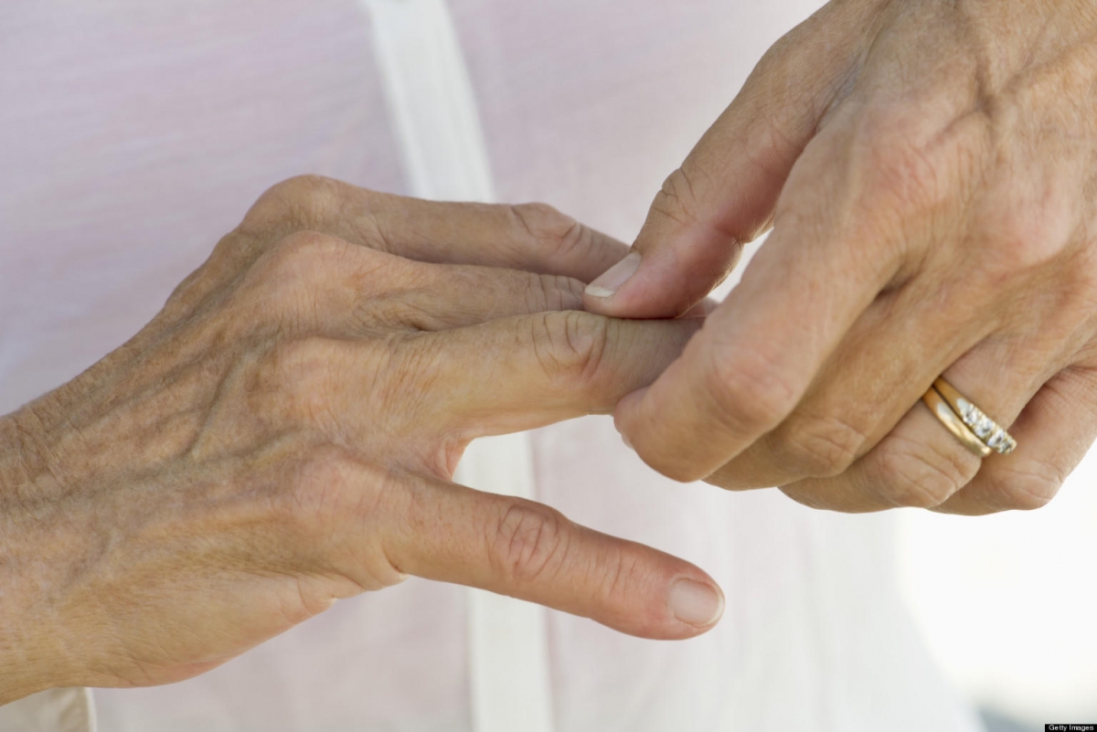 Altos costos obligan a pacientes de artritis a dejar tratamientos