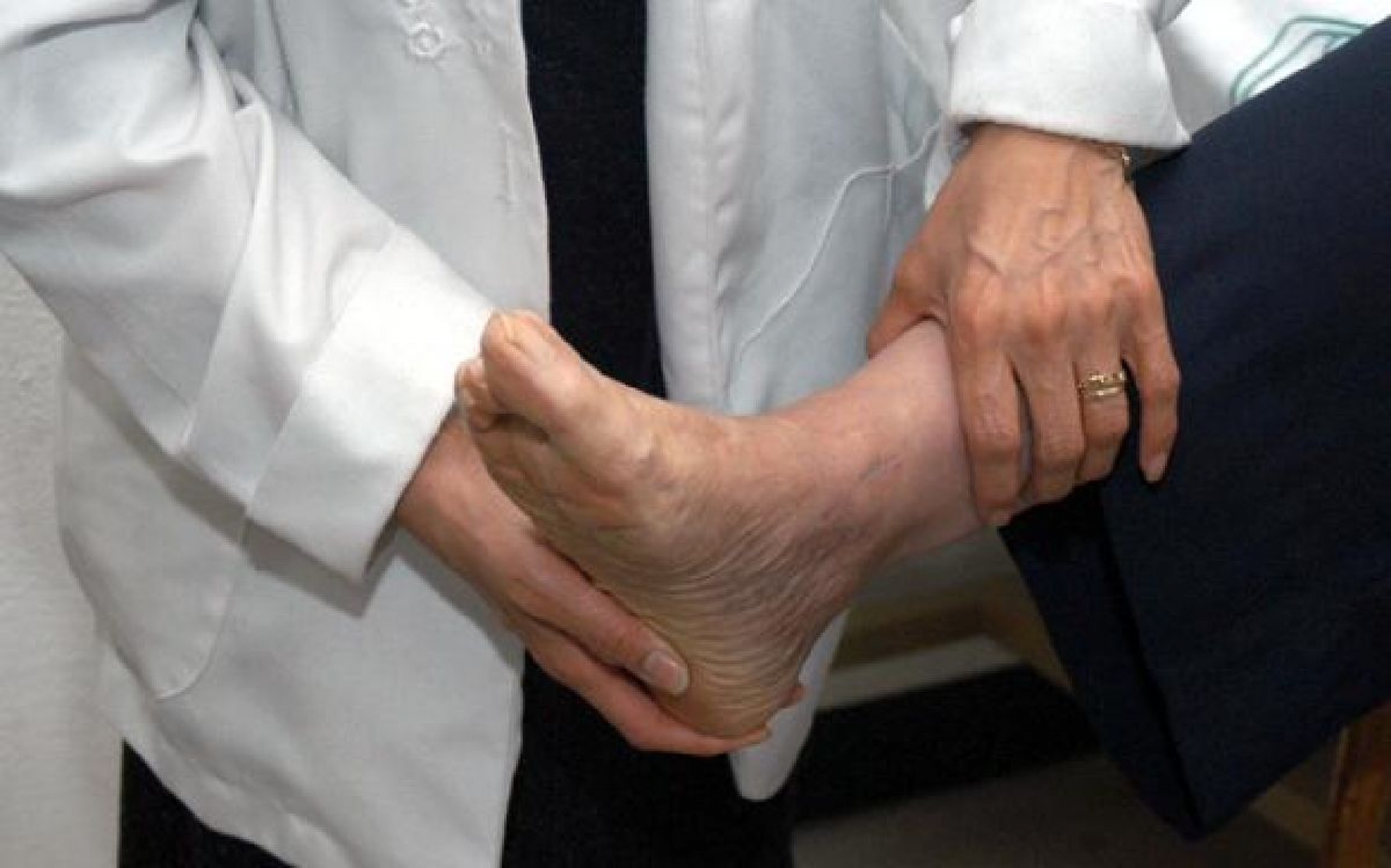 Dolor de talón, padecimiento que afecta a personas que trabajan de pie o caminando