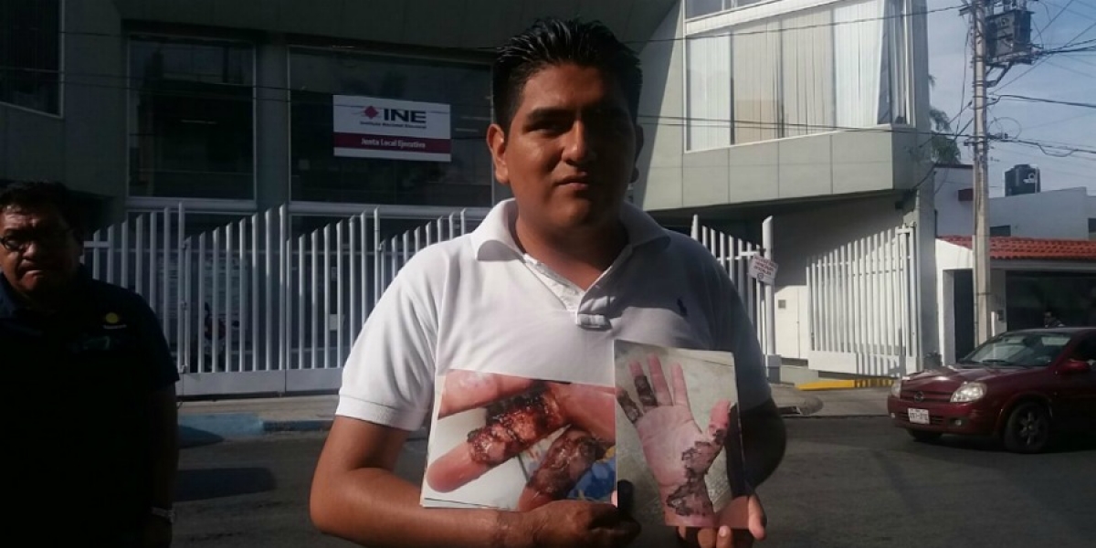 Reclama ex funcionario de casilla en Jiutepec, ante el INE, omisión del pago de gastos médicos