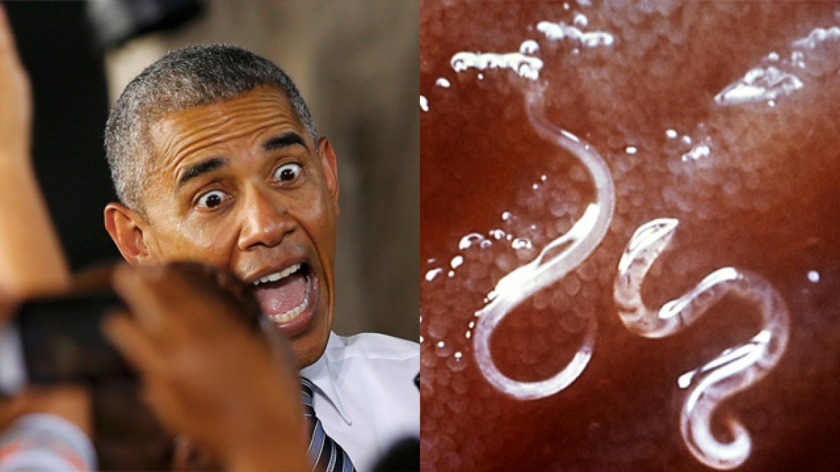 Nombran a un parásito en honor a Barack Obama por “largo, delgado y genial”