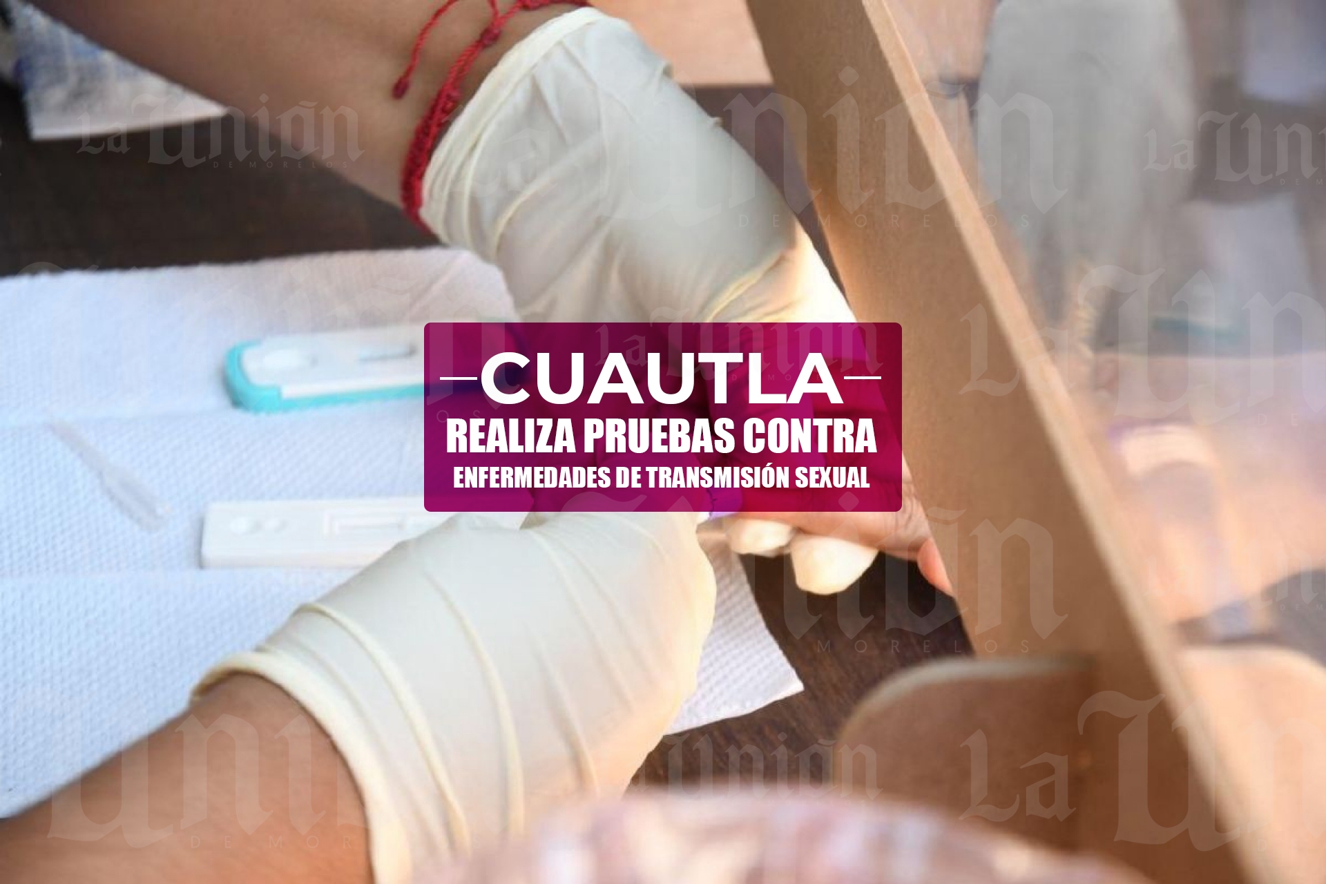Cuautla el 2° municipio con mayor número de personas con VIH