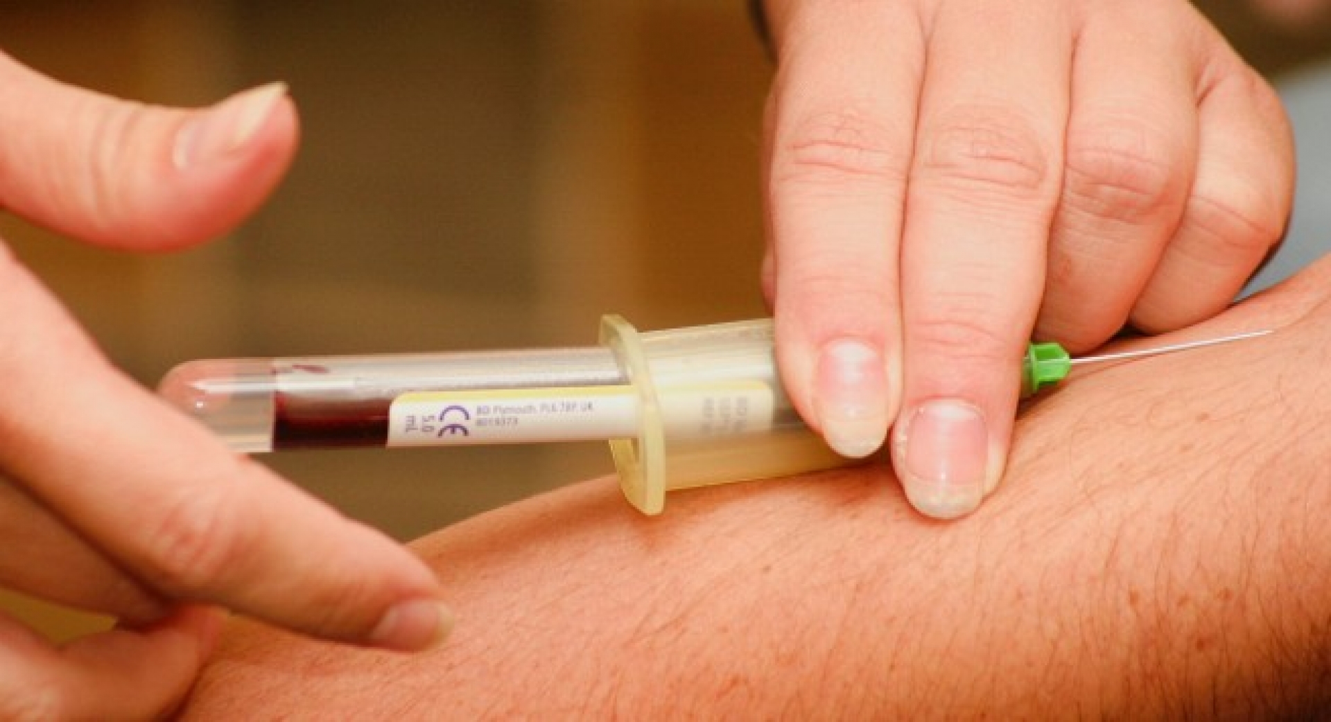 IMSS tratará Covid-19 con plasma; si te curaste así puedes donar