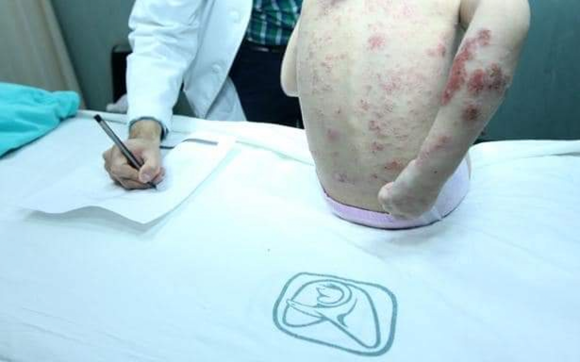La lepra es curable cuando se cuenta con diagnóstico oportuno: IMSS Morelos
