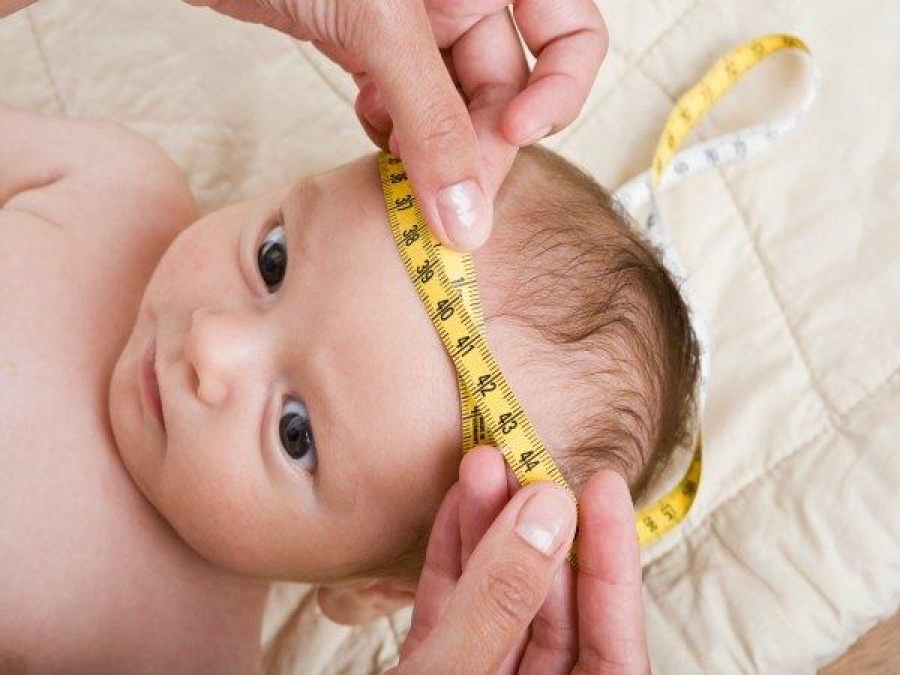 Embarazada con zika en México tuvo a su bebé sin problemas