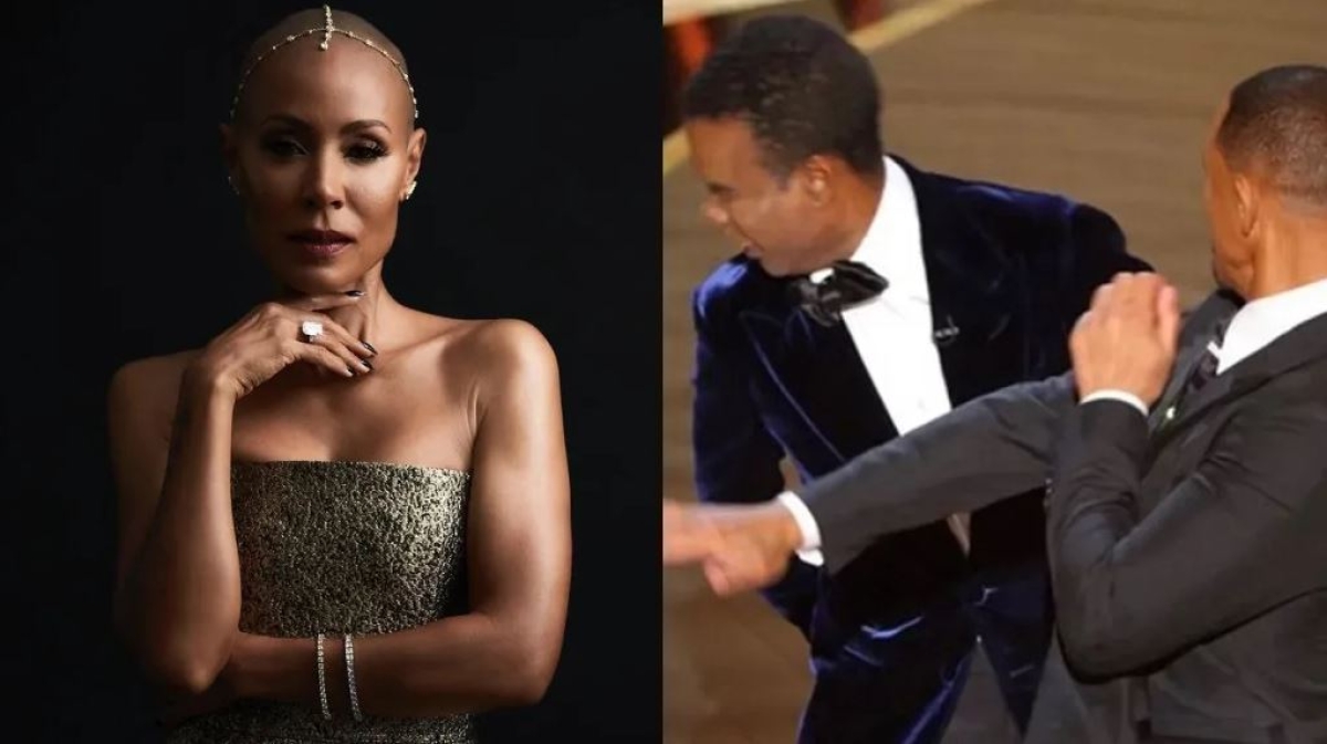 ¿Qué es la alopecia? El padecimiento de Jada Pinkett, esposa de Will Smith