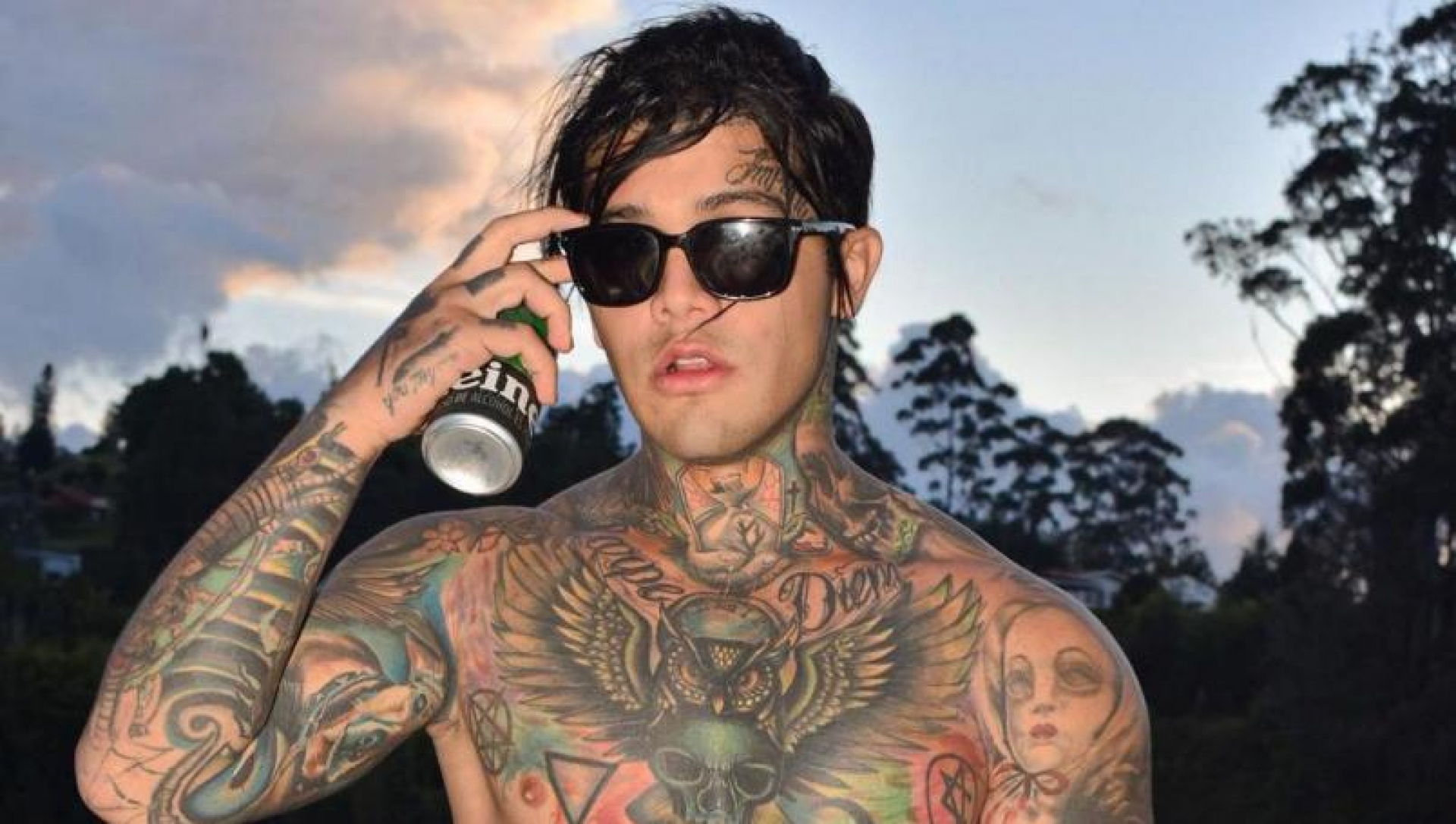 YouTuber Yeferson Cossio se pone implantes de senos