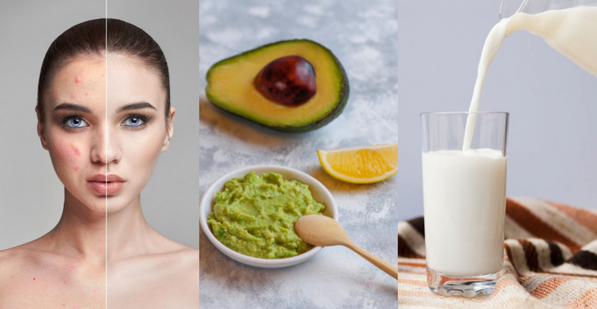 Cuatro alimentos para evitar la piel grasa y eliminar las ojeras