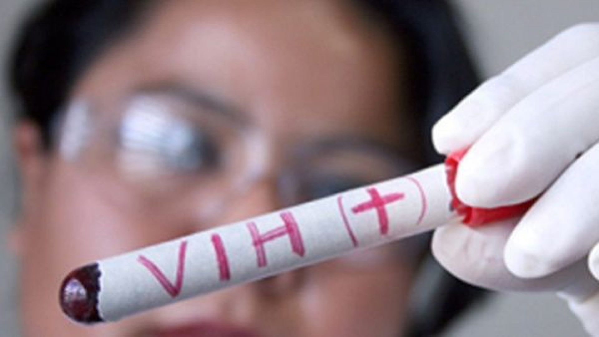 Cuautla se ubica en segundo lugar en infecciones de VIH