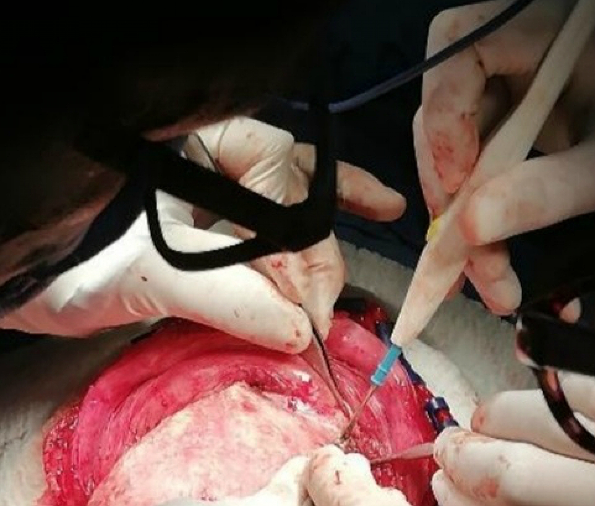 Cuenta HNM con amplio programa de neurocirugía y cirugía maxilofacial