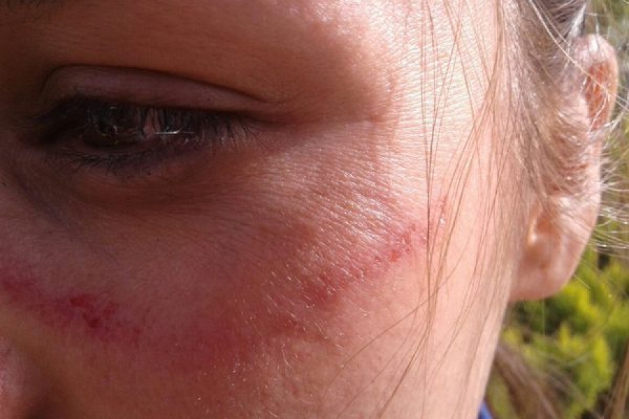 Un individuo agredió a golpes a su sobrina