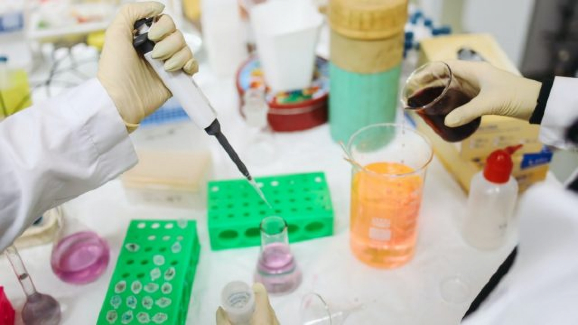 Alemania invierte 300 mde en laboratorio que trabaja en vacuna contra Covid-19