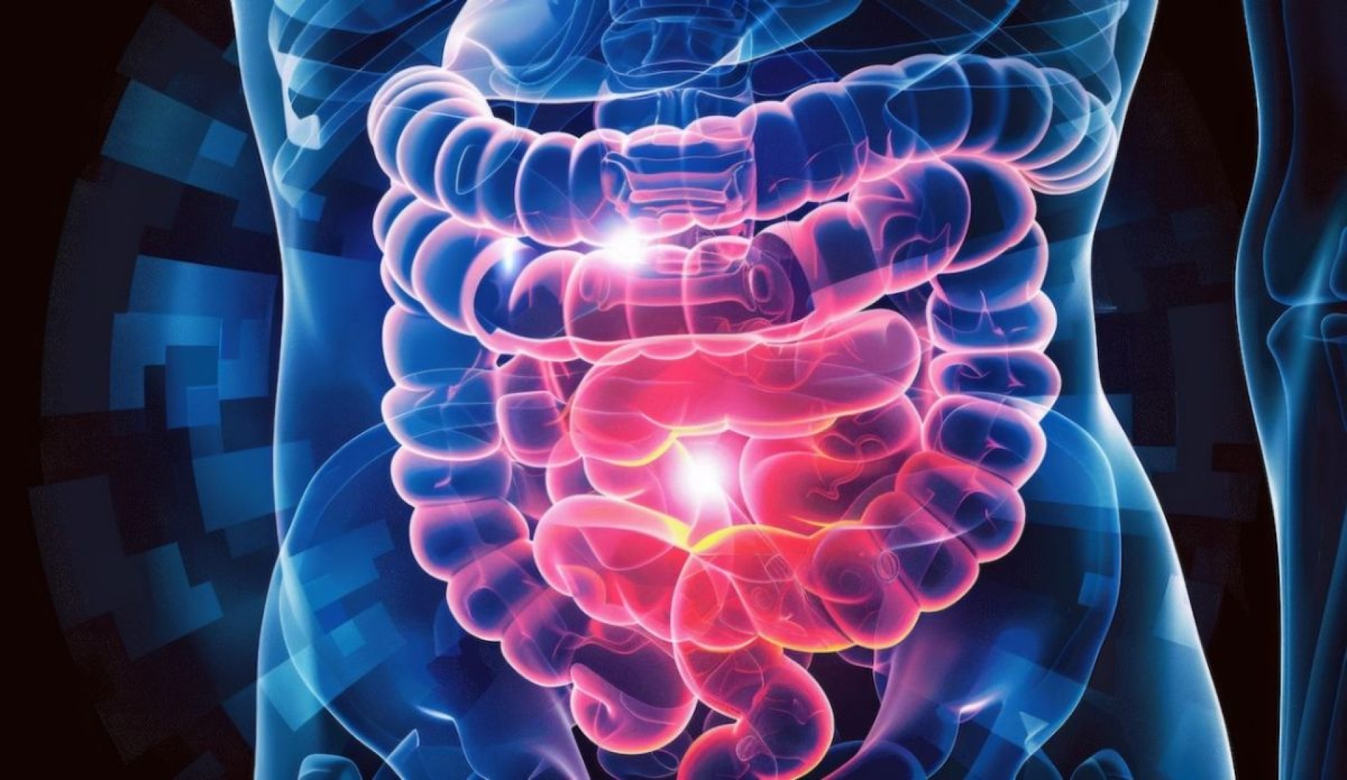 ¿Podrían los antibióticos aumentar el riesgo de cáncer colorrectal?