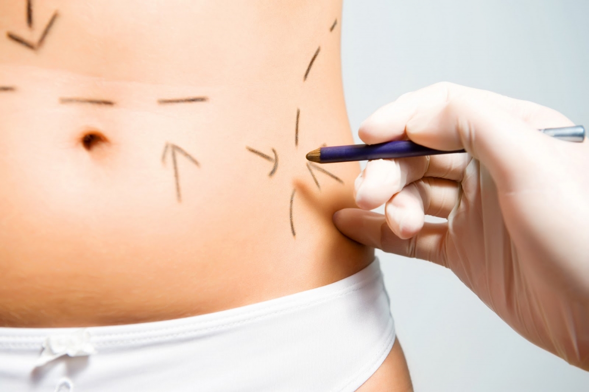 Previenen sobre servicios de cirugía estética fraudulentos