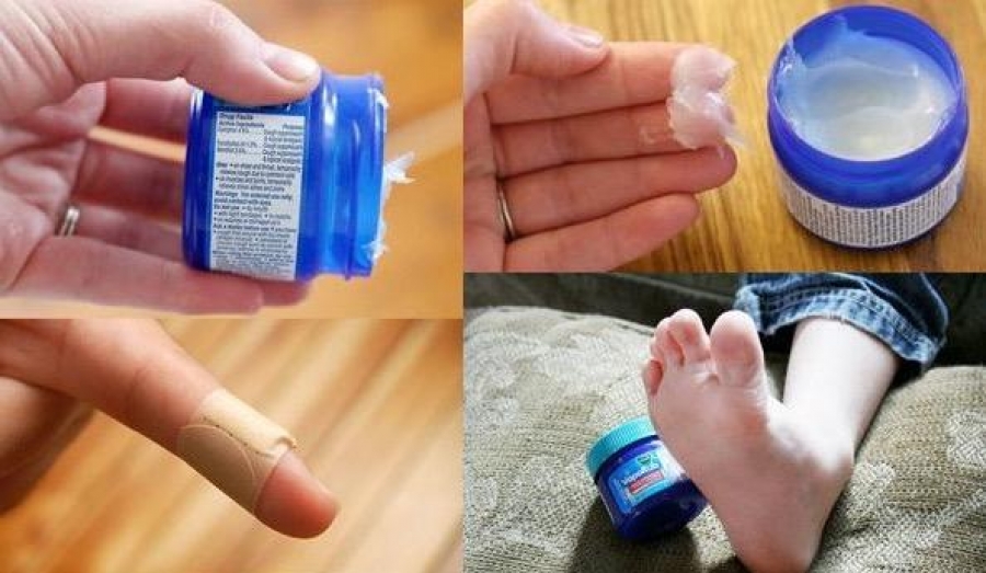 Los múltiples usos del Vicks VapoRub