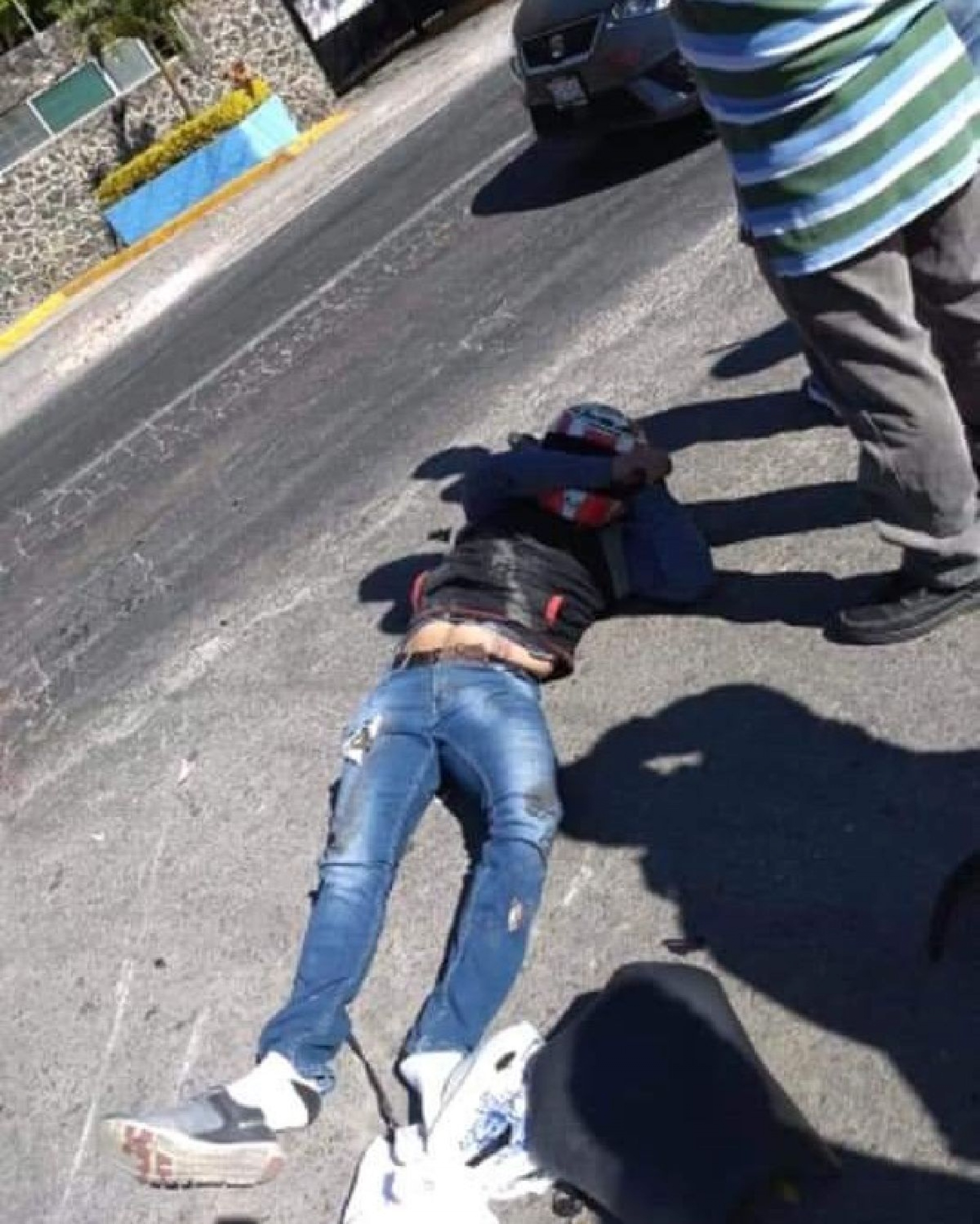 Sufrió fracturas al derrapar en una moto