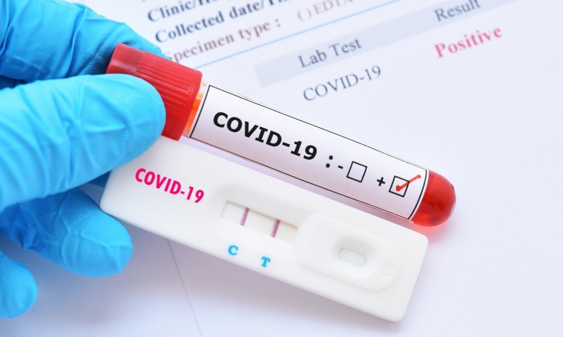Instalarán más puntos de pruebas COVID en plazas y farmacias de CDMX